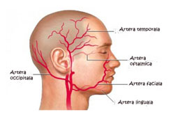 Arterita Temporala