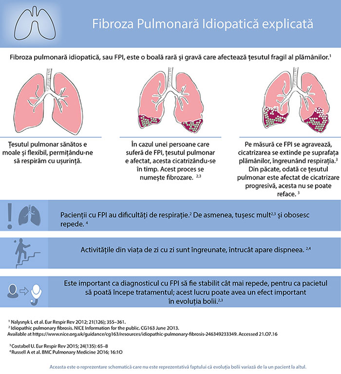 Infografic Fibroza Pulmonara Idiopatică